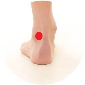 Blase 60 liegt zwischen der Achillessehne und dem äußeren Knöchel.