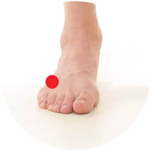 Gallenblase 41 liegt im Gewebe zwischen dem kleinen Zeh und dem Nachbarzeh.