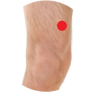 Milz 10 befindet sich ca. 3 Querfinger oberhalb des Kniegelenks an der Oberschenkelinnenseite.