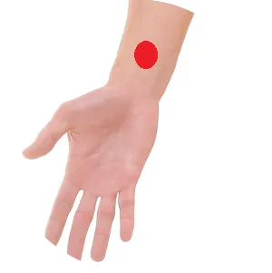 Perikard 6 liegt an der Innenseite des Unterarms, ca. 2 Querfinger von der Handgelenksfalte zwischen zwei Sehnen.