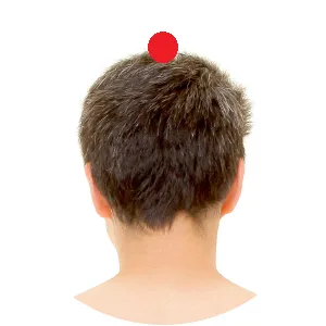 Du Mai 20 befindet sich am höchsten Punkt des Schädels.