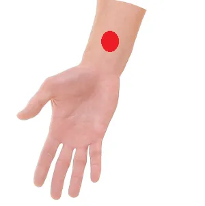 Perikard 6 liegt an der Innenseite des Unterarms, ca. 2 Querfinger von der Handgelenksfalte zwischen zwei Sehnen.