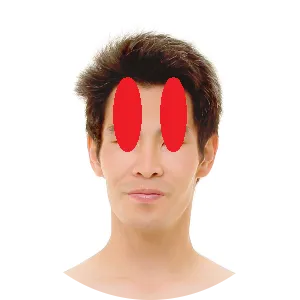 Das Areal liegt über den Augen.