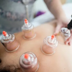 Das trockene Schröpfen ist eine wunderbare Alternative zur Eigenblutbehandlung.