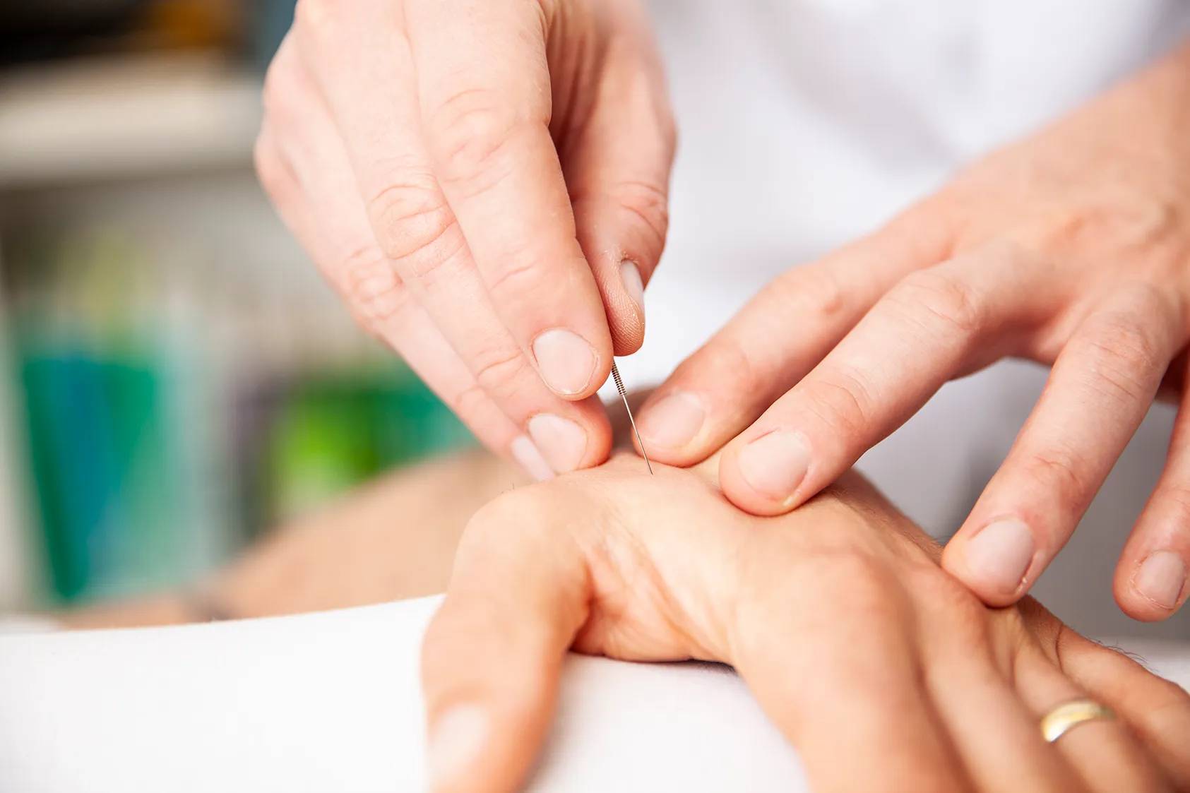 Heilpraktiker setzt Akupunkturnadel an der Hand