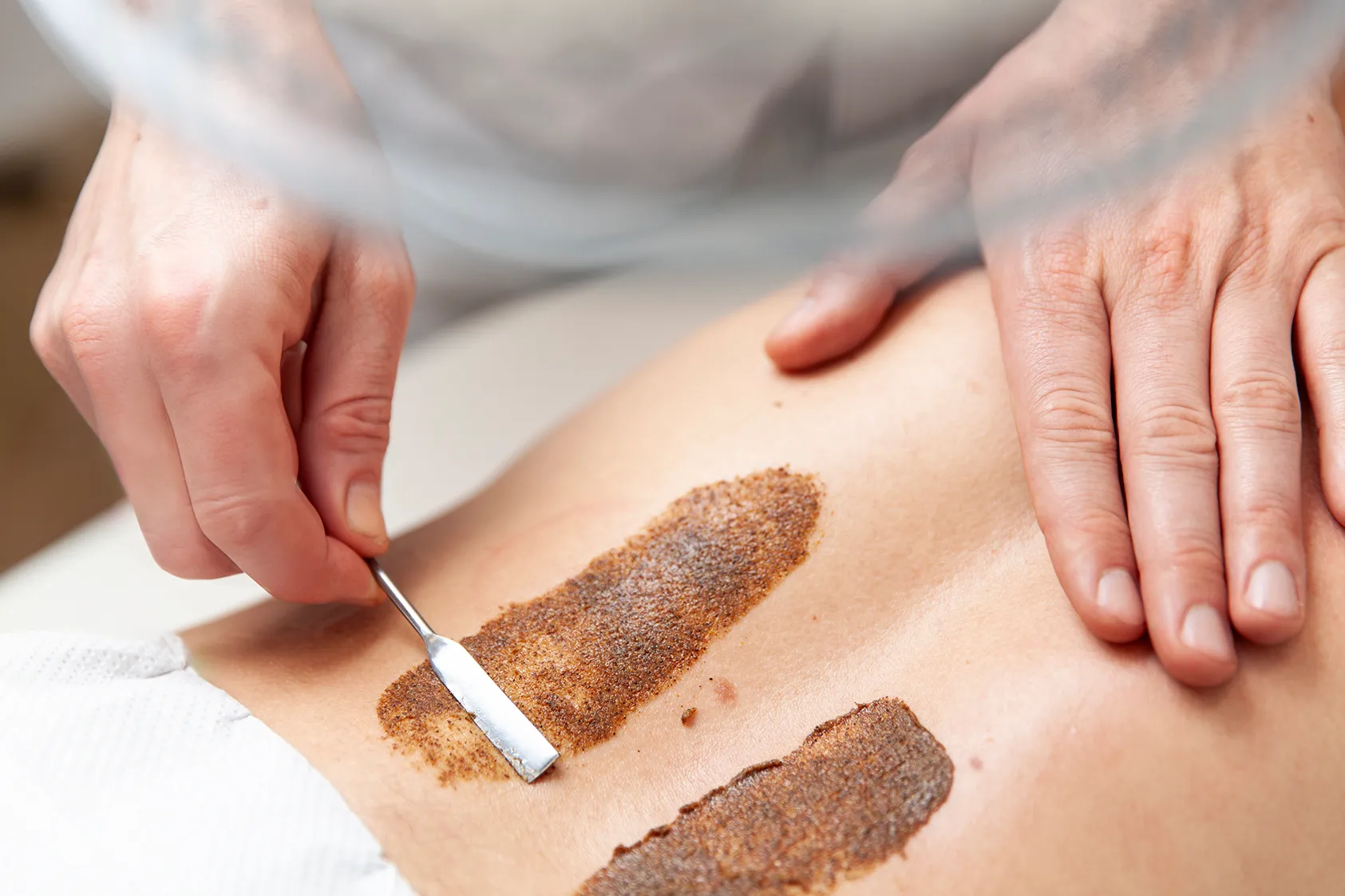 Heilpraktiker wendet Wärmetherapie an