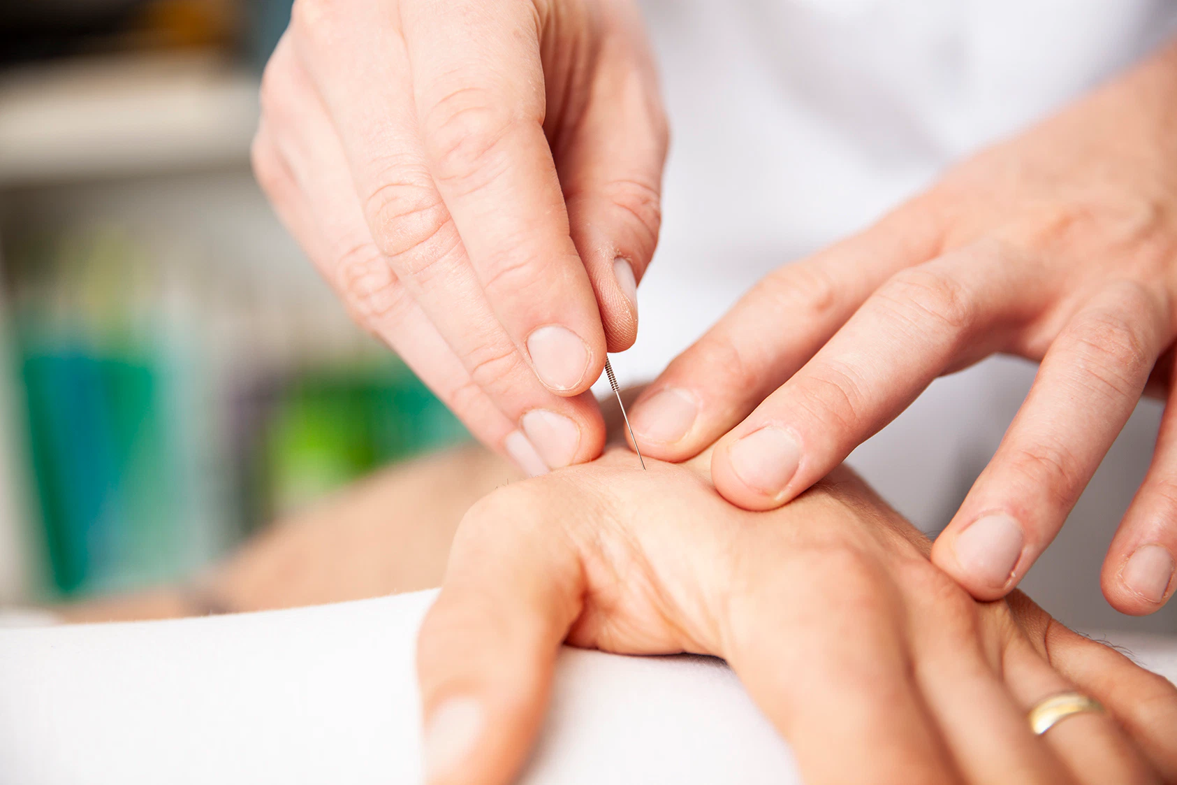 Heilpraktiker Rick Putzer stimuliert eine Akupunkturpunkt-Nadel an der Hand eines Patienten.